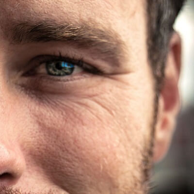 5 وصفات منزلية لإزالة التجاعيد والخطوط الرفيعة