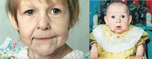 حالة بنجامين بتن المحيرة