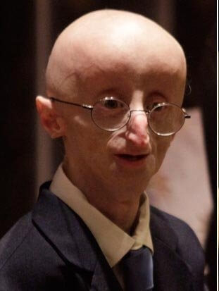 حالة بنجامين بتن المحيرة