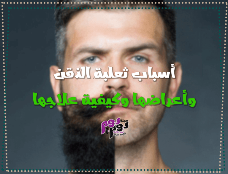 beard alopecia areata