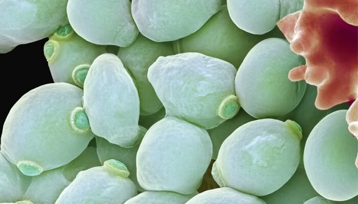 عدوى الخميرة عند الرجال