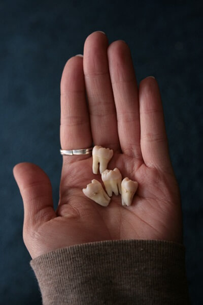 تفسير رؤية تساقط الاسنان في المنام للحامل