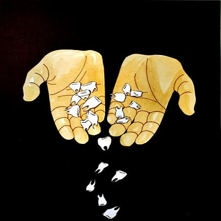 تفسير سقوط الأسنان في الحلم للمتزوجة