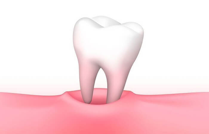 تفسير رؤية تبديل أماكن الأسنان في الحلم