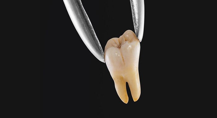 تفسير رؤية تخلخل الأسنان في المنام