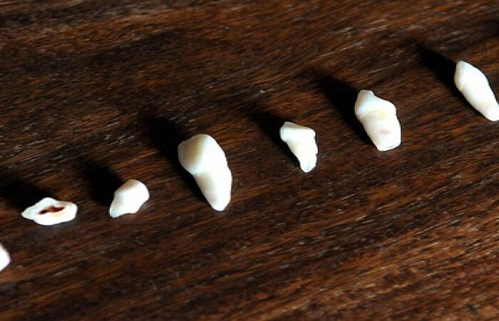 سقوط الاسنان في المنام