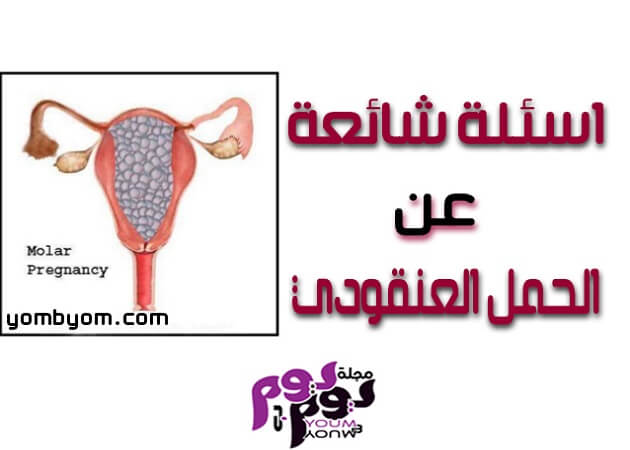 اسئلة شائعة عن الحمل العنقودي