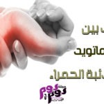 الفرق بين الروماتويد والذئبة الحمراء