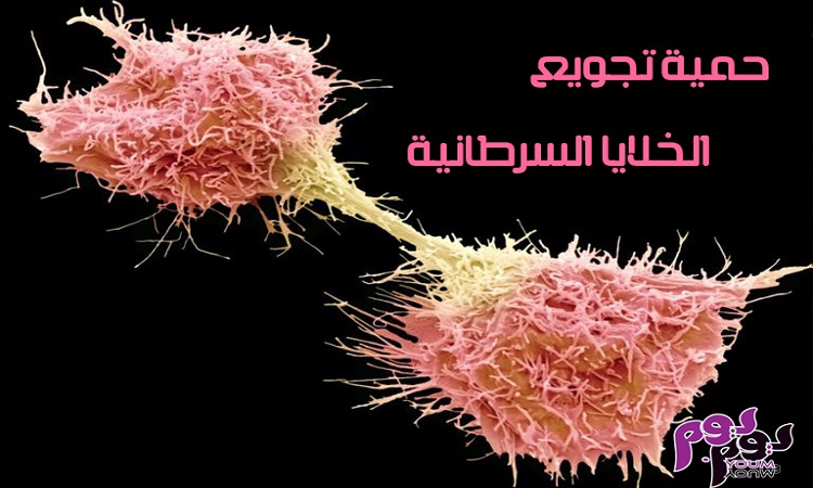 حمية تجويع الخلايا السرطانية