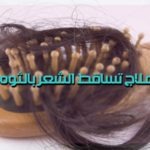 علاج تساقط الشعر بالثوم