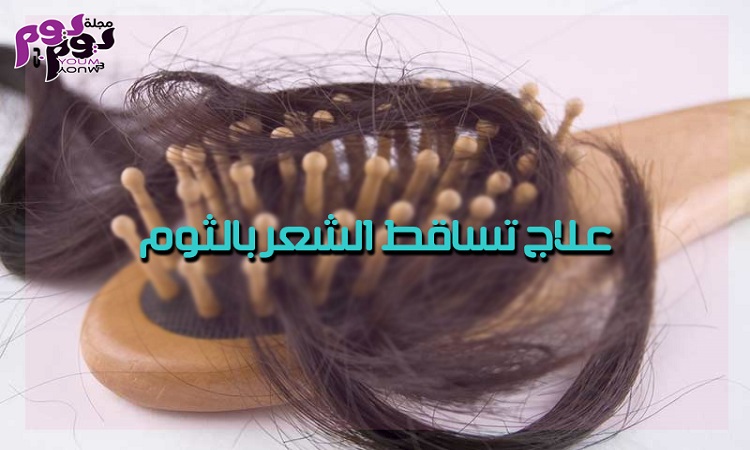 علاج تساقط الشعر بالثوم