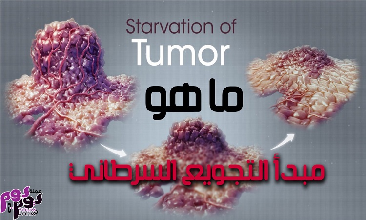 ما هو مبدأ التجويع السرطاني