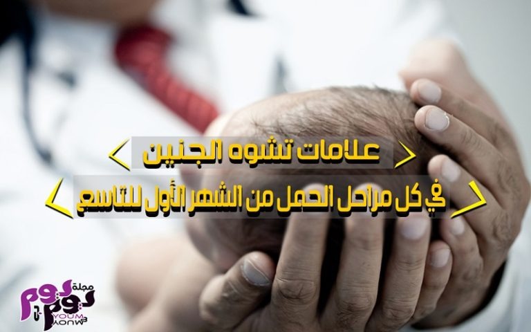 علامات تشوه الجنين