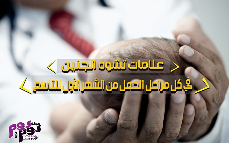 علامات تشوه الجنين