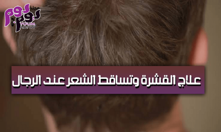 علاج القشرة وتساقط الشعر عند الرجال