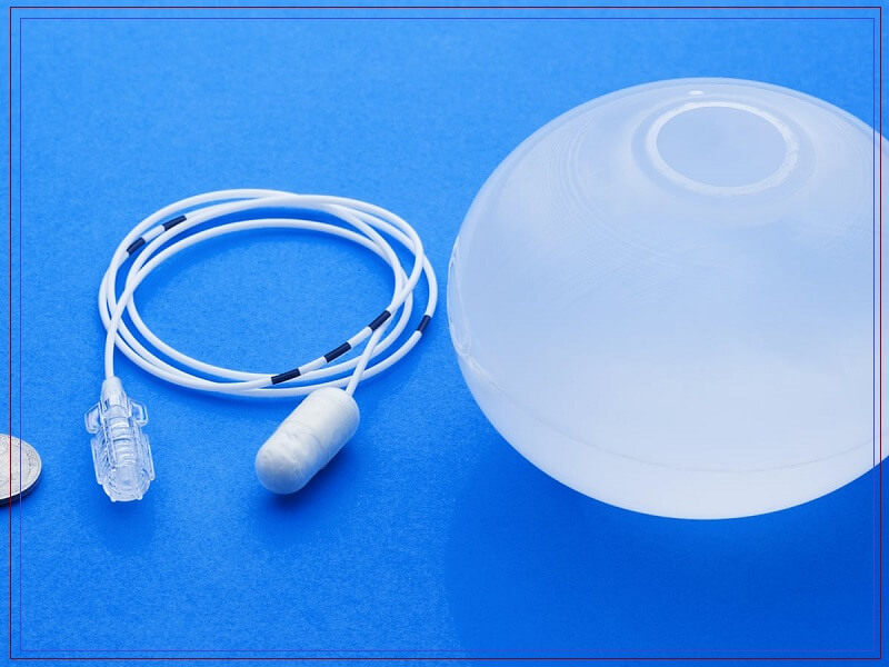 الكبسولة الذكية بالون المعدة