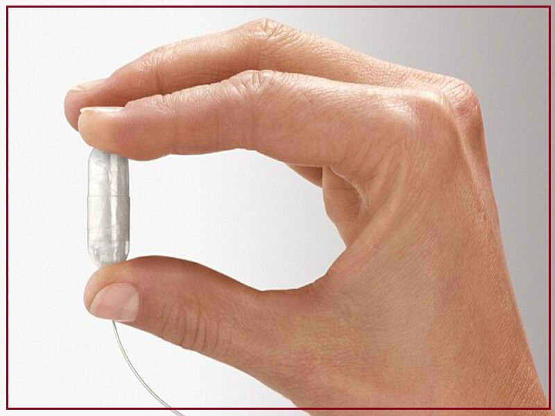 Smart capsule stomach balloon