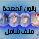 بالون المعدة - Intragastric balloon