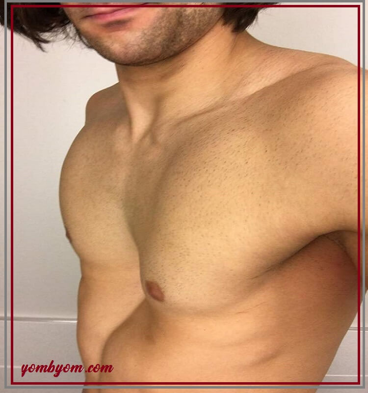 جراحة تشوهات الصدر