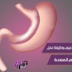 جراحة تكميم المعدة