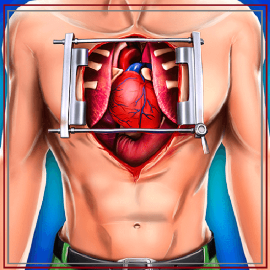 open heart surgery