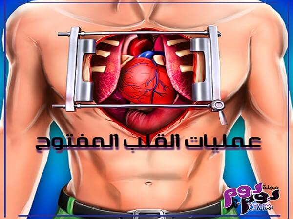 عمليات القلب المفتوح