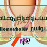 البواسير Hemorrhoids